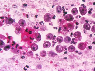 o-NAEGLERIA-FOWLERI-facebook