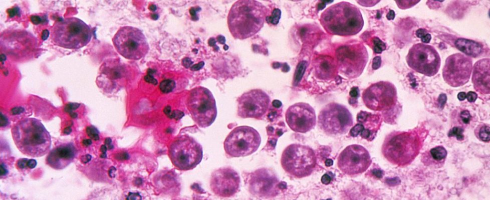 o-NAEGLERIA-FOWLERI-facebook