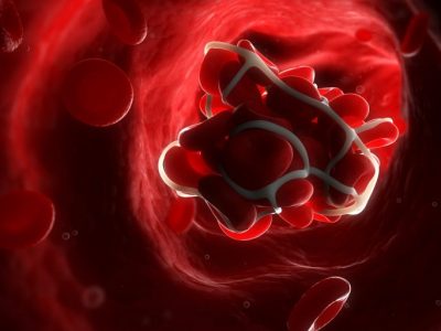 o-BLOOD-CLOT-facebook