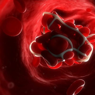 o-BLOOD-CLOT-facebook