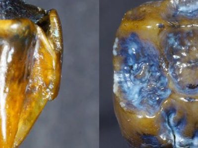725-hominin-teeth_1024