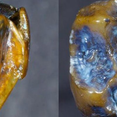 725-hominin-teeth_1024