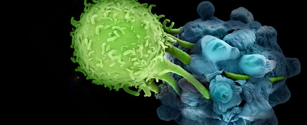 cáncer triple negativo, sistema inmune, tratamiento inmune, tratamiento de cáncer, quimioterapia, inmunoterapia, enfermedad agresiva